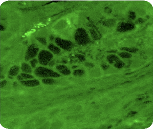 ヒトの胃における生検標本。明るく輝く緑の蛍光反転部分がL.ロイテリ菌の集落化